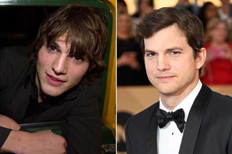 Ashton Kutcher before and after plastic surgery.